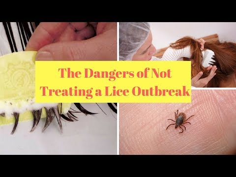 The Dangers of Not Treating a Lice Outbreak
