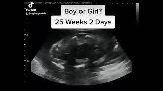 Gender Reveal Ultrasound At 25 Weeks 2 Days Pregnant