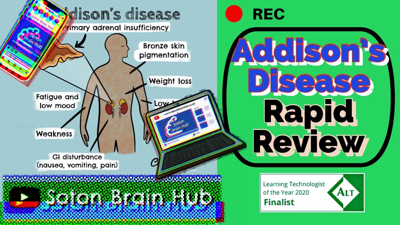 Download Addison's Disease Rapid Review