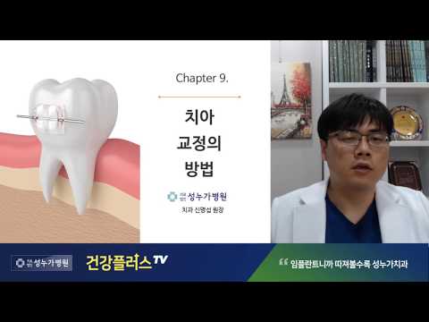 치아교정 방법 1편 - 성누가병원건강플라스TV 25화