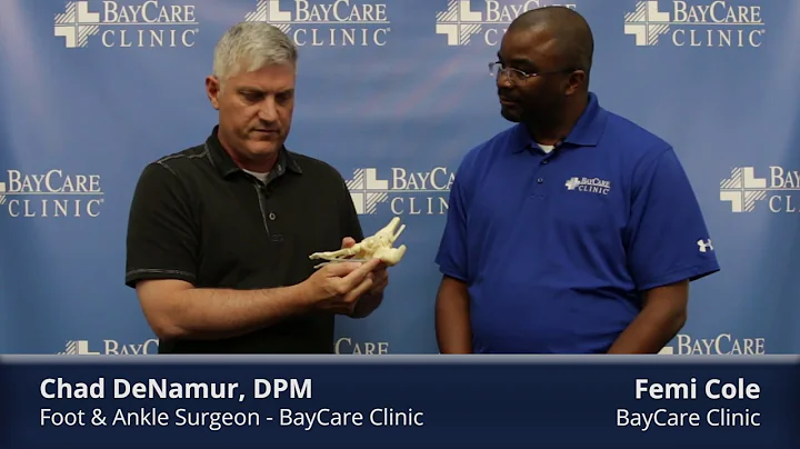 BayCare Clinic Minute: What is plantar fasciitis?