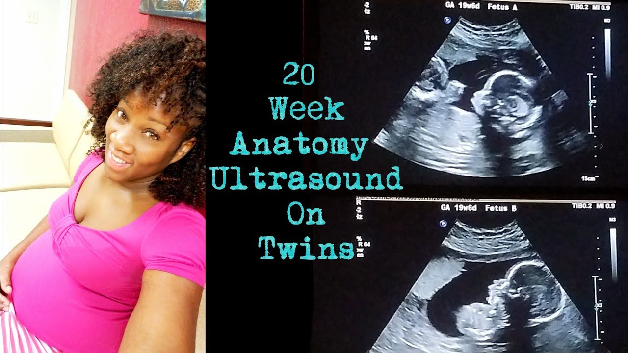 20 Weeks Pregnant With Twins Ultrasound