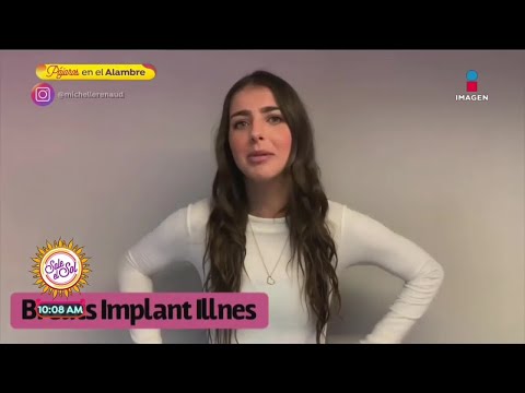 Vídeo: Michelle Renaud Escondeu Que Usava Implantes Mamários