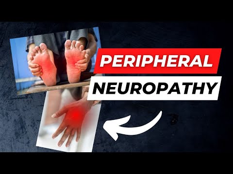 What is Peripheral Neuropathy? What can be done about it?