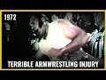 Terrible ARMWRESTLING injury (1972)