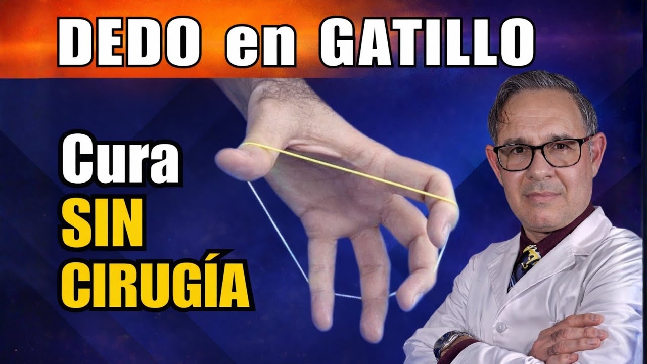 DEDO en GATILLO (o resorte): EVITA la CIRUGÍA con este TRATAMIENTO EFECTIVO