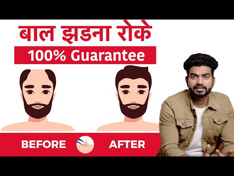 stop-hair-fall-guarantee-|-बाल-झड़ना-रोके-|-male-pattern-baldness-cure-|-by-house-of-anabolics