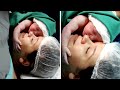 Emotional Moment Newborn Clings To Mother's Face