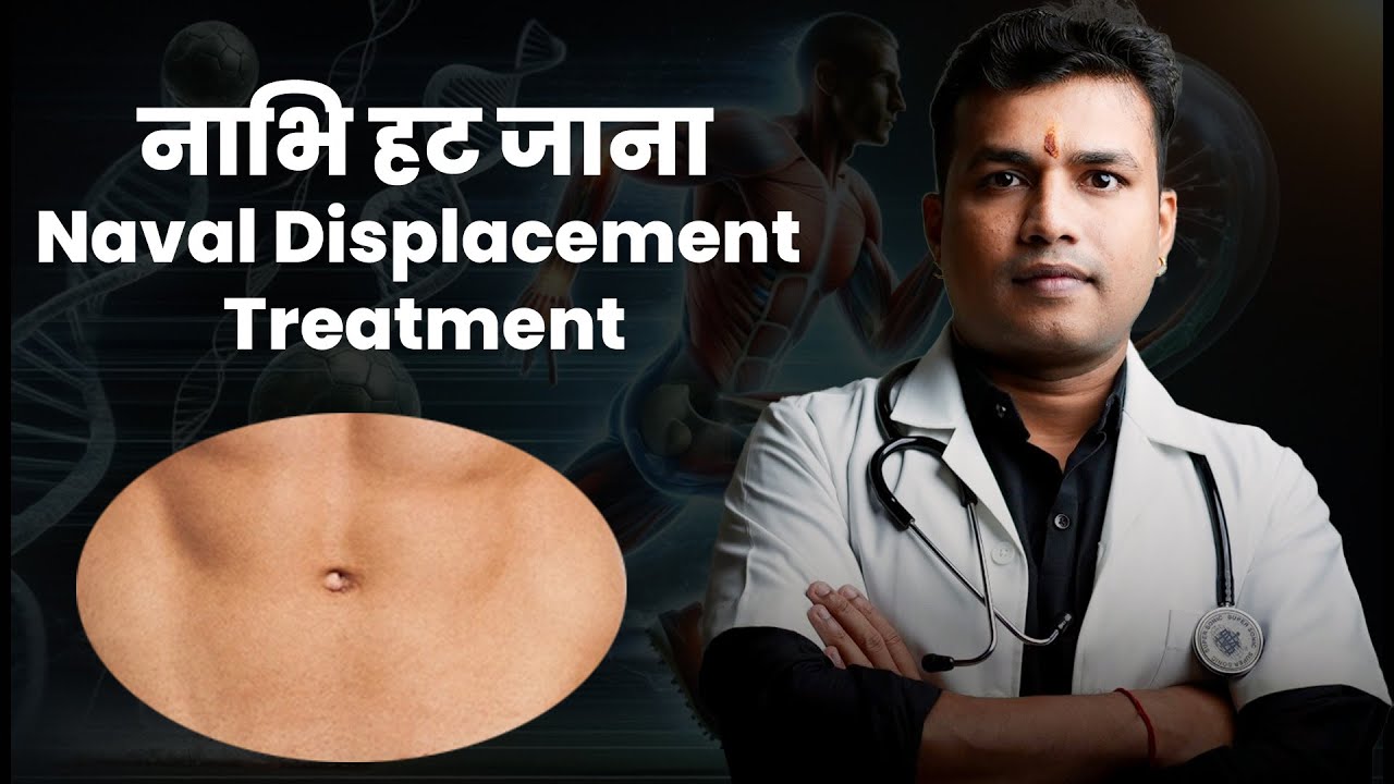 नाभि हटना/खसक जाना-Naval Displacement Treatment #mishraveda #oj Ayurveda #drarunmishra