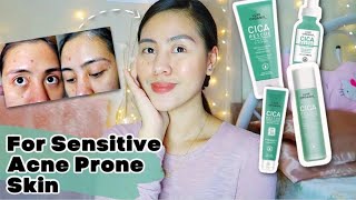 LUXE ORGANIX CICA RESCUE  REVIEW (CLEANSER, TONER, SERUM, RECOVER CREAM) ~  7 DAYS | steffiray🥭