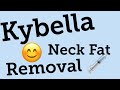 Kybella Neck Fat Removal