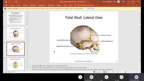 Ch 9 Head and Neck Anatomy