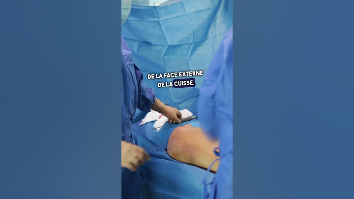 Comment se déroule une lipoaspiration ? 🤔