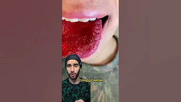 ужасные трещины на языке