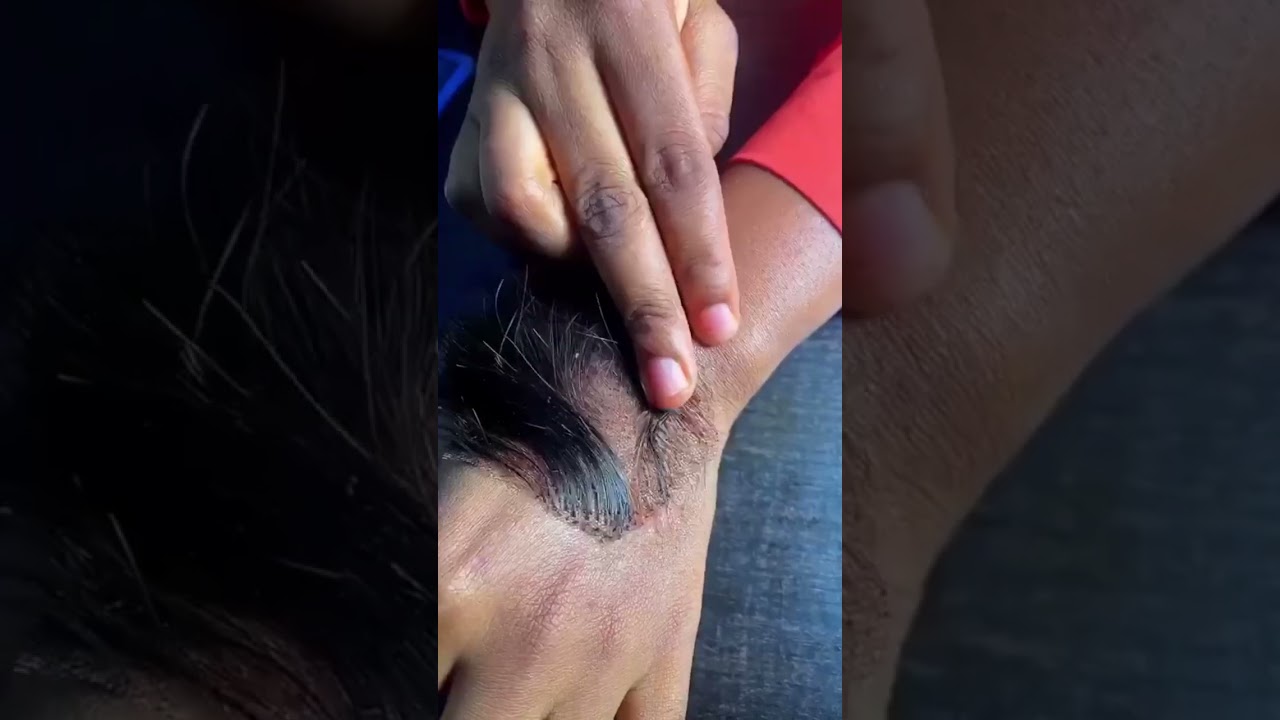 How to install glueless with our melting spray and glue removal