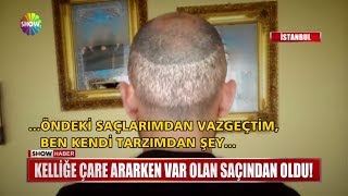 Kelliğe çare ararken  var olan saçından oldu!