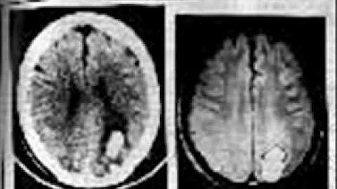 Dr Estabrooks Hypnosis