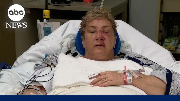 Pennsylvania Woman Recounts Bear Attack From Hospital Bed