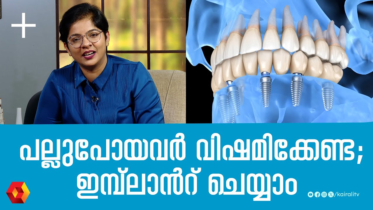 ഡെന്റൽ ഇമ്പ്ലാന്റ് നല്ലതാണോ | Is a dental implant good or not |Dental implant surgery Benefits