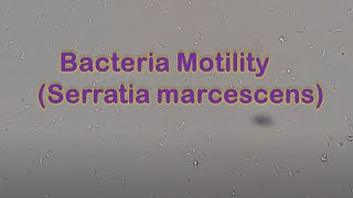 Bacteria Motility | Serratia marcescens