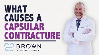 What Causes a Capsular Contracture? | Brown Plastic Surgery