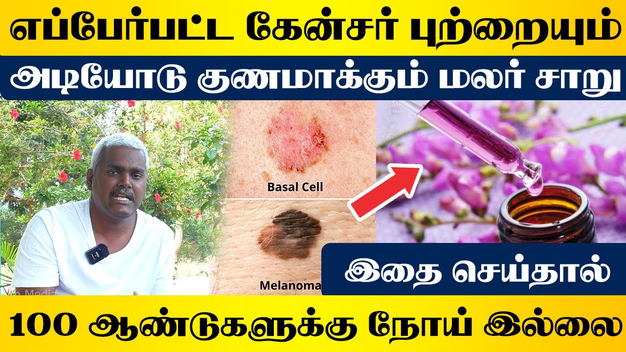 எப்பேர்பட்ட கேன்சர் புற்றையும் அடியோடு குணமாக்கும் மலர் சாறு | 100 ஆண்டுகளுக்கு நோய் இல்லை | யோகம்