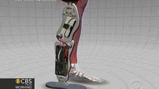 New bionic leg merges man and machine