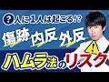 【必見】ハムラ法のリスクとは？裏ハムラで傷を最小限にするためのこだわり【目の下のクマ】