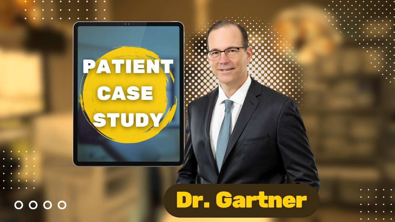Patient Case Study with Dr. Gartner 1600 Grafts Procedure Nova