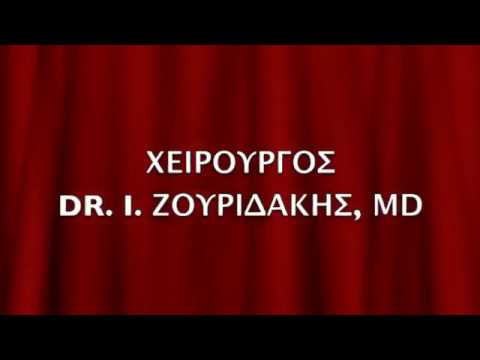 SLEEVE GASTRECTOMY - ΓΑΣΤΡΙΚΟ ΜΑΝΙΚΙ-DR. I. ΖΟΥΡΙΔΑΚΗΣ