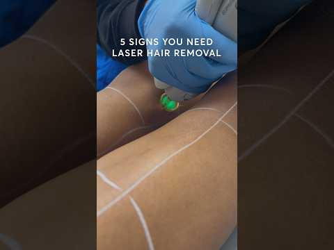 The Beauty Hack You Wish You Knew Sooner | #laserhairremoval #hairremoval #beautyclinic