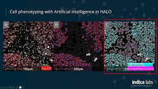 Getting Started with Multiplex Fluorescence Image Analysis in HALO®
