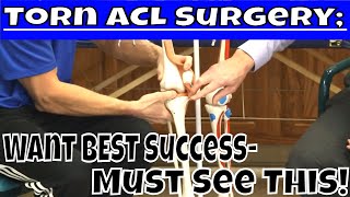 Torn Acl Surgery Want Best Success- Must See This