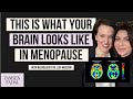 How to manage your brain in menopause  tamsen fadal