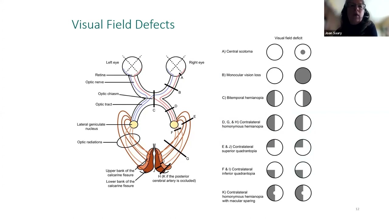 Migraines and safety sensitive work – An evidence-based update