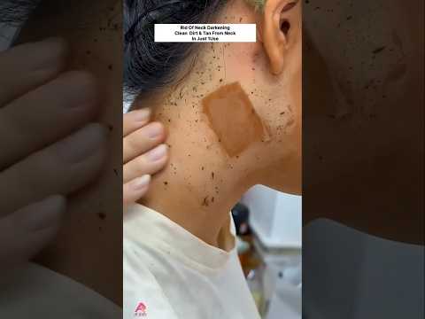 Clean Dirt & Tanning From Neck In 1 Use | Dark Neck Cleaning Tips | #shorts #beauty #skincare #viral