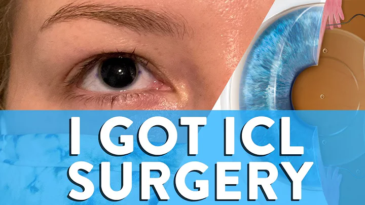 I Got ICL Surgery! My Video Walk-Through Of Entire ICL Surgery Experience. NO LASIK!