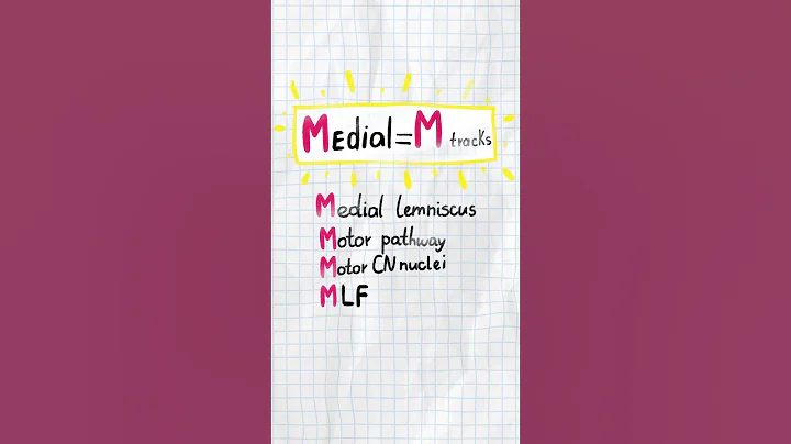 🧠 Master the Rule of 4s!
