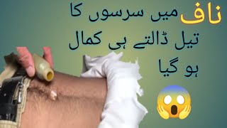 Mustard oil for bellybutton||naf me sarso ka tel lagane ke fayde||Miss SK Hacks