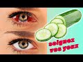 FORGET YOUR GLASSES WITH THIS SUPER CUCUMBER EYE TREATMENT Improve Eyesight Naturally