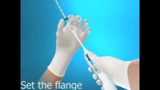 Animation for insertion of Mirena IUD