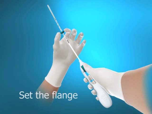 Animation for insertion of Mirena IUD class=