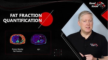 ⁠Good to Know - Fat Fraction Quantification (FFQ)