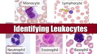 Identifying Leukocytes