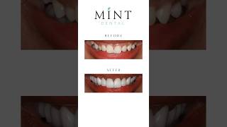 Amazing work done by Dr. Forest. ✨ Amazing work done by Dr. Forest. ✨