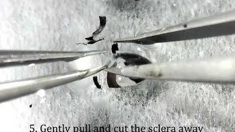 [Experimental procedure] Eyeball dissection (retinal flat-mount preparation)