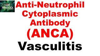 ANCA-ассоциированные васкулиты | MPA, GPA и EGPA | Патология простыми словами