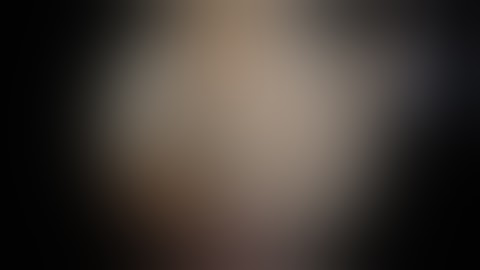 An All-Arthroscopic, Length-Tensioned Suprapectoral Biceps Tenodesis Technique