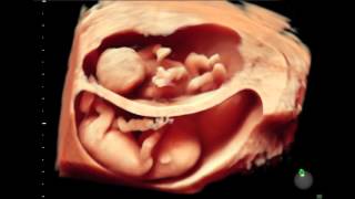GE Voluson HDlive ultrasound imaging
