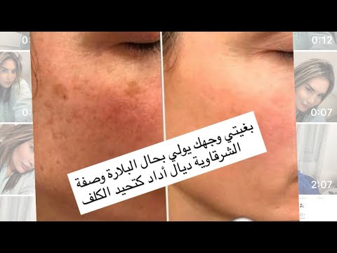 Wasfa Laklefff Dial Aded 